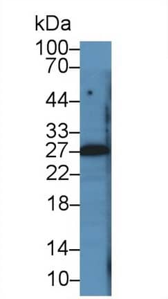 PTHLH/PTHrP Antibody (D1)