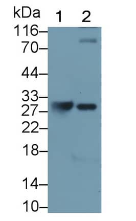 Granzyme K Antibody (C1)