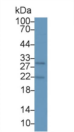 PTHLH/PTHrP Antibody (D4)