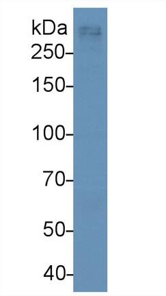 Apolipoprotein B100/ApoB100 Antibody (D10)