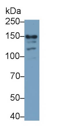 NMDAR2D Antibody (C5)