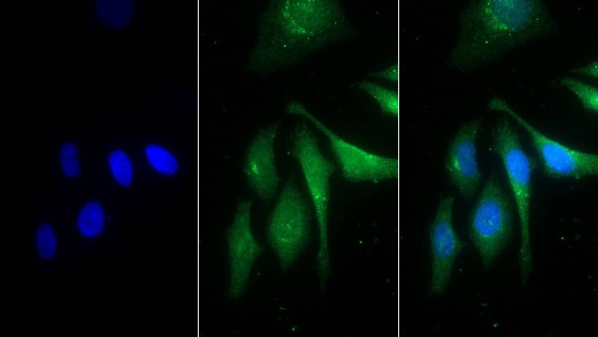 PSAP Antibody (D4)