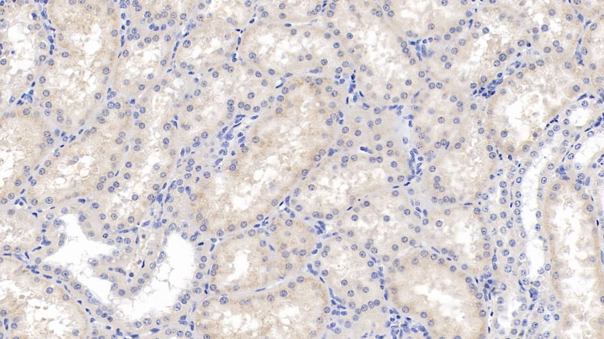 Eosinophil derived neurotoxin Antibody (C11)