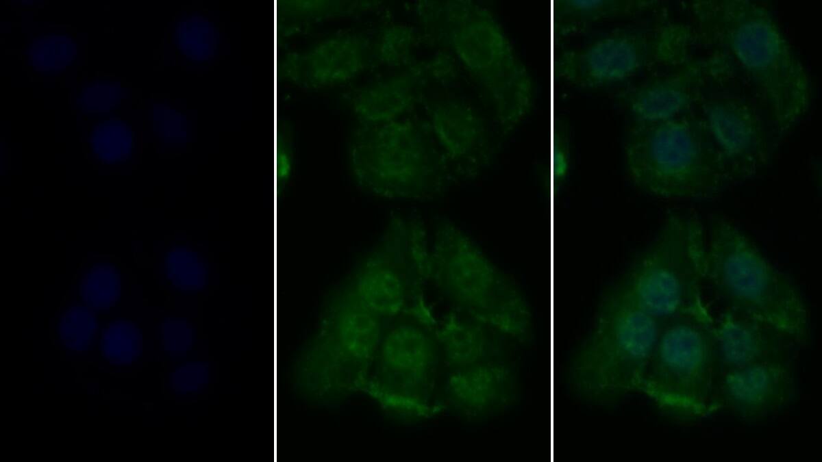 RIPK1/RIP1 Antibody (C2)