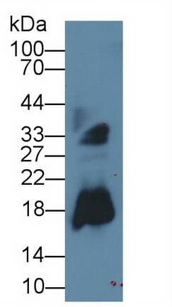 Eosinophil derived neurotoxin Antibody (C10)