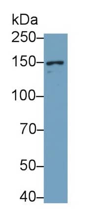 NMDAR2D Antibody (C6)