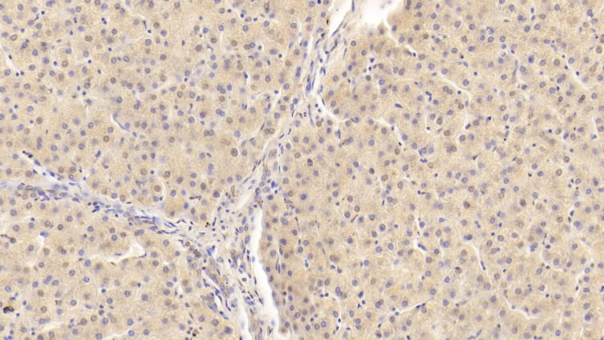 Apolipoprotein B100/ApoB100 Antibody (D8)