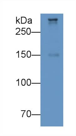 Apolipoprotein B100/ApoB100 Antibody (D8)