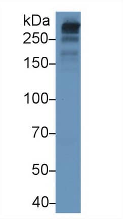 Apolipoprotein B100/ApoB100 Antibody (D5)