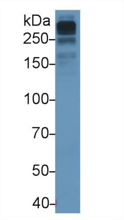 Apolipoprotein B100/ApoB100 Antibody (D7)