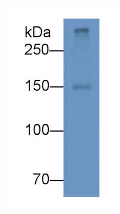 Apolipoprotein B100/ApoB100 Antibody (D3)