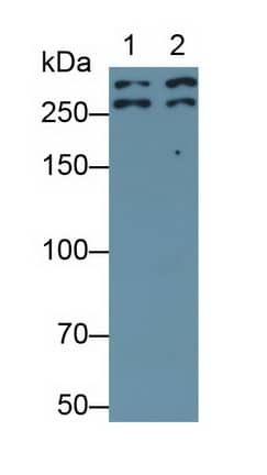 Desmoplakin Antibody (C1)