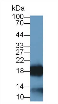 Eosinophil derived neurotoxin Antibody (C1)