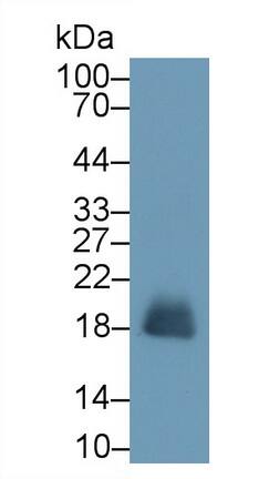 Eosinophil derived neurotoxin Antibody (C9)