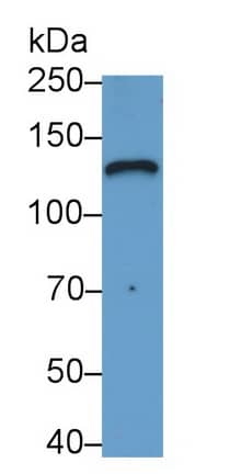 LAMC2 Antibody (D1)