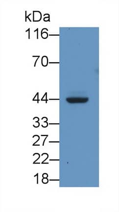 HLA C Antibody (C21)