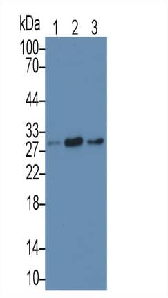 MAPRE1 Antibody (C8)