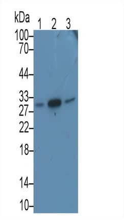 MAPRE1 Antibody (C7)