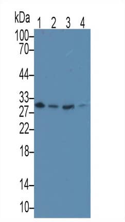 MAPRE1 Antibody (C10)