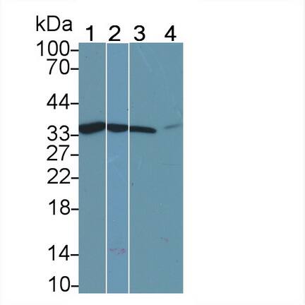 Calponin 2 Antibody (C8)