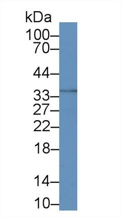 Calponin 2 Antibody (C5)