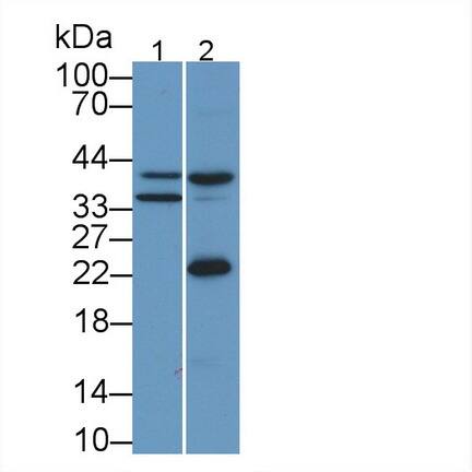 Apolipoprotein L2 Antibody (C6)