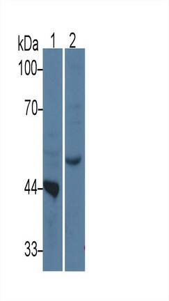 TDO2 Antibody (C10)