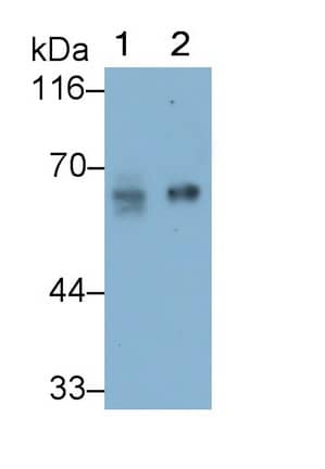 PSAP Antibody (D8)