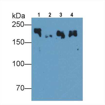 MYH8 Antibody (C1)