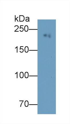 MYH8 Antibody (C3)