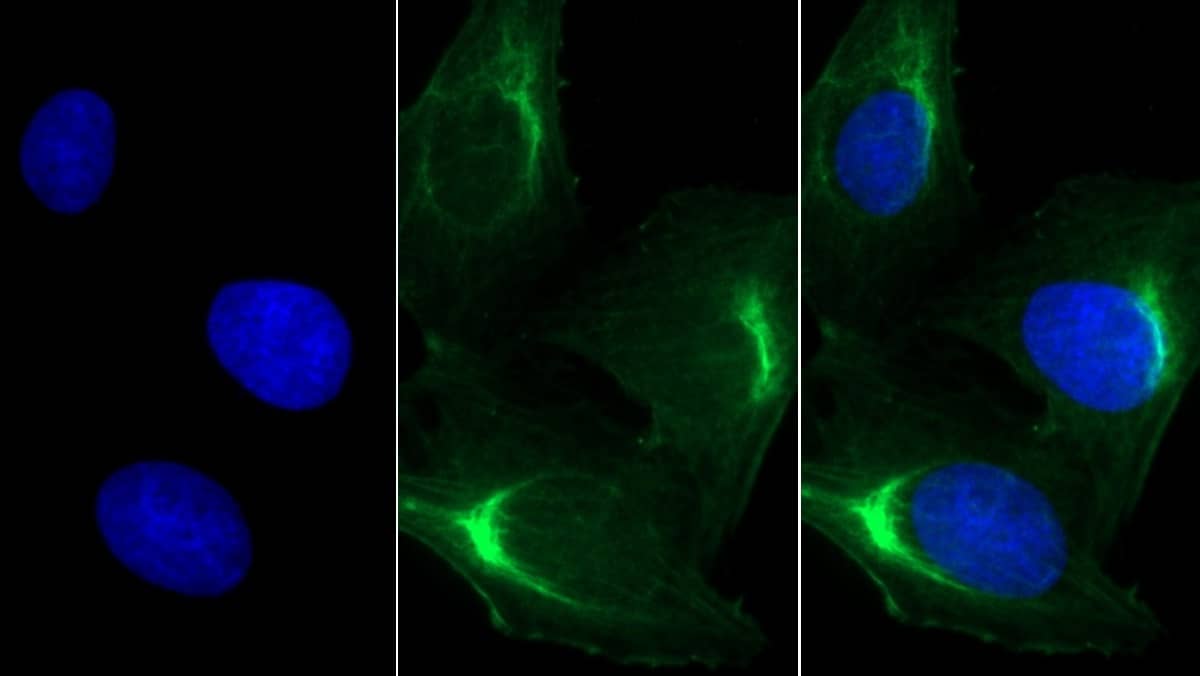 MYH8 Antibody (C3)