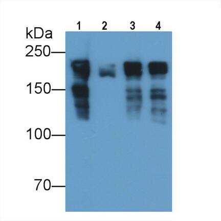 MYH8 Antibody (D1)