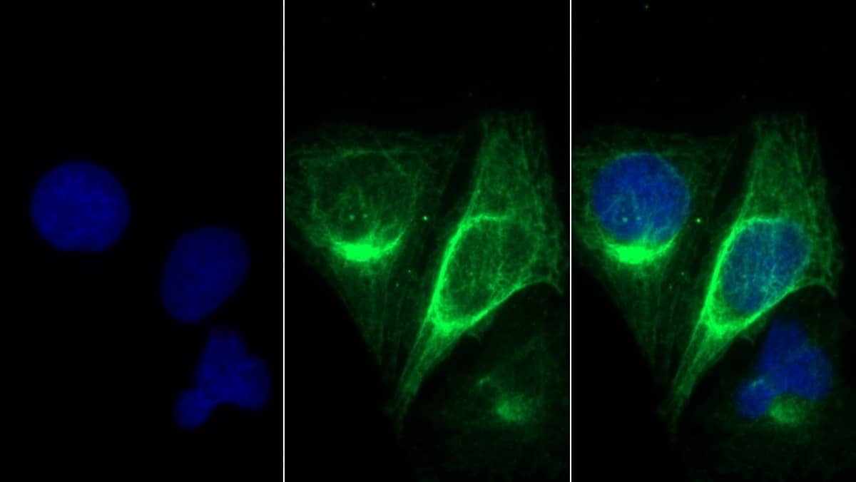 MYH8 Antibody (D1)