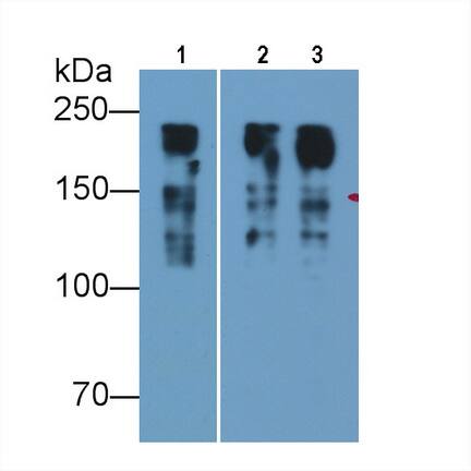 MYH8 Antibody (D2)