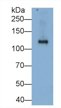 SI Sucrase-Isomaltase Antibody (C1)