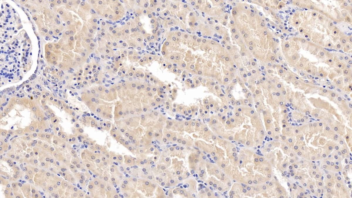 MAPRE1 Antibody (C4)