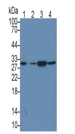 MAPRE1 Antibody (C4)