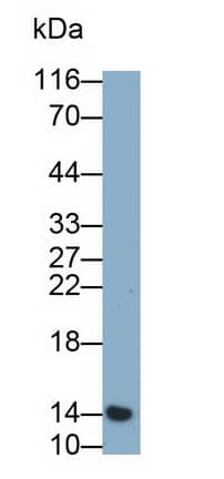 Cystatin S Antibody (C3)