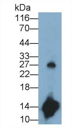 Cystatin S Antibody (C8)