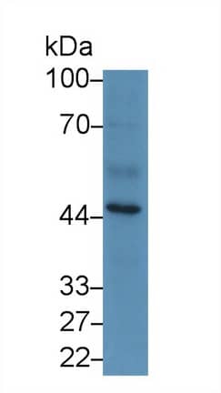 Serpin A10/ZPI Antibody (C2)