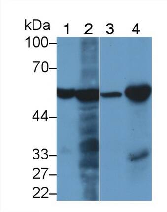 Phenylalanine Hydroxylase Antibody (C4)