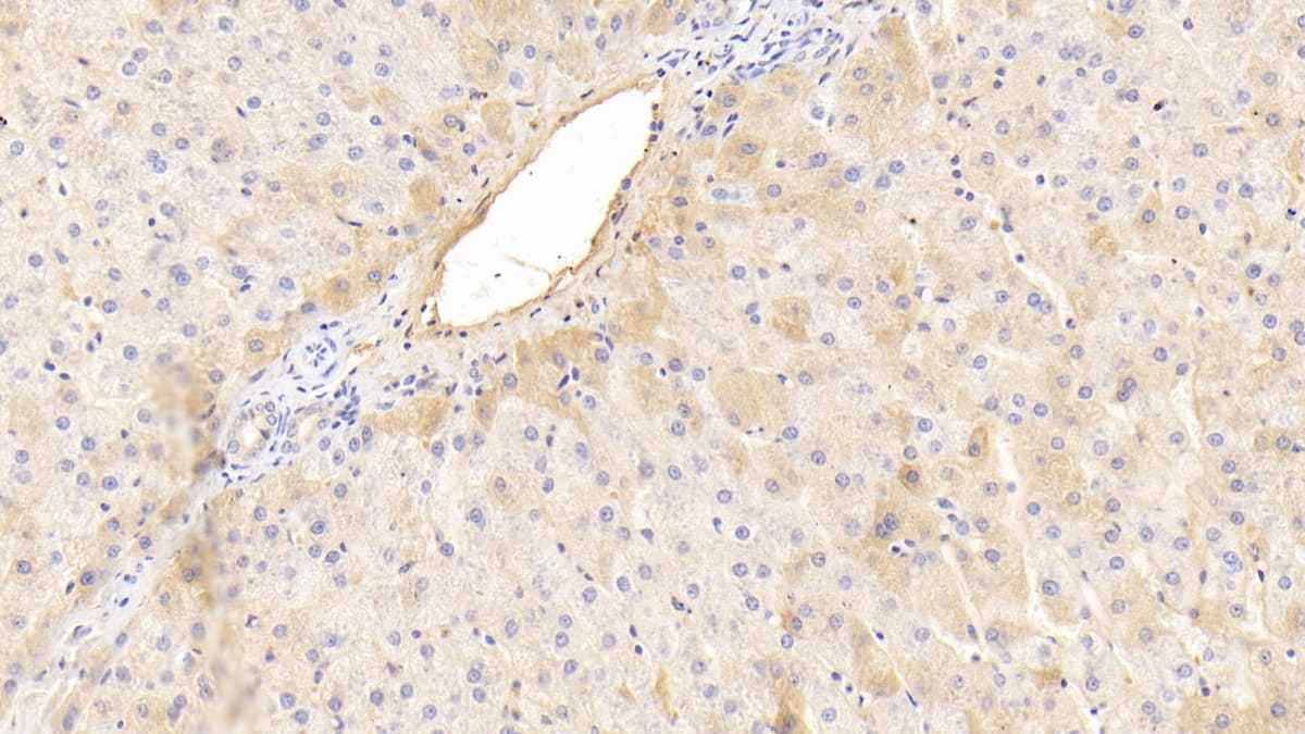 Phenylalanine Hydroxylase Antibody (C4)