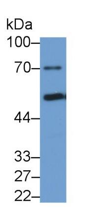 Phenylalanine Hydroxylase Antibody (C11)