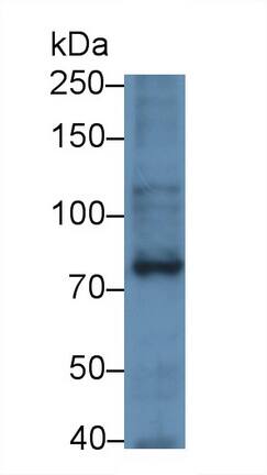 SLC6A4/5-HTTLPR/Serotonin transporter Antibody (C1)