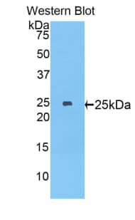 MYH8 Antibody