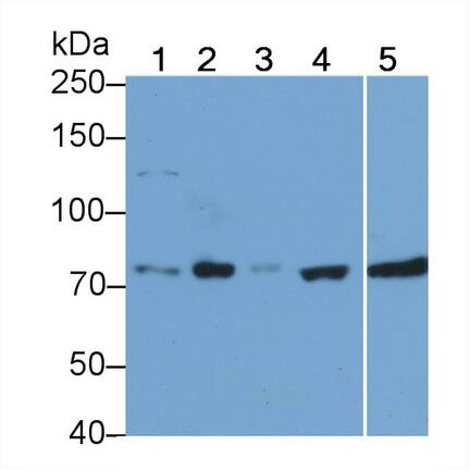 RIPK1/RIP1 Antibody (C4)