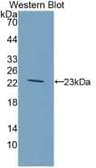 GCKR Antibody (4#)