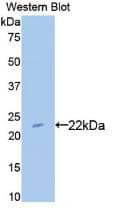 BLMH/Bleomycin Hydrolase Antibody (6#)