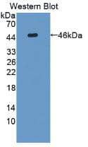 IL-31 Antibody (A3)