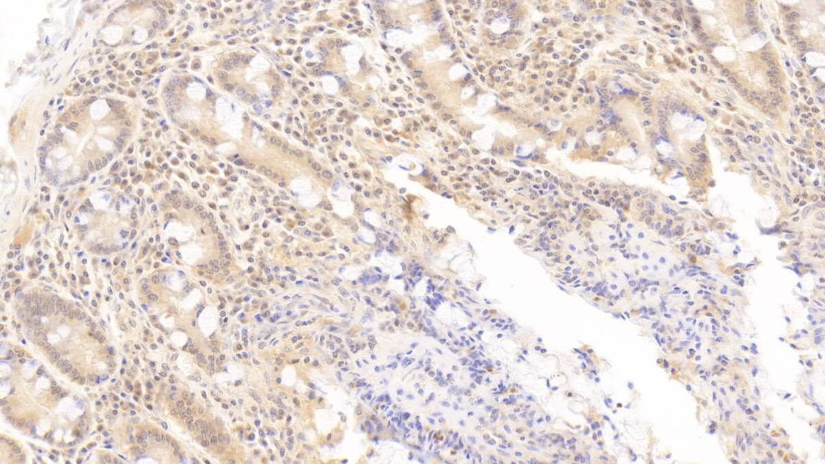 OAS1 Antibody (C12)